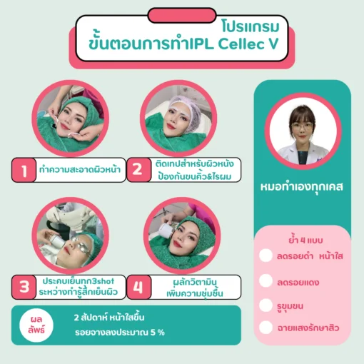 รีวิวผลลัพธ์คอร์สรักษาสิวระดับ 2 รอยสิวจางลงชัดเจน วรวลัญช์ คลินิก