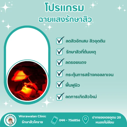 โปรแกรมเลเซอร์รักษารอยสิวและรูขุมขน ระดับ 3 วรวลัญช์ คลินิก โคราช