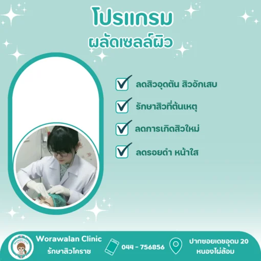 ชุดยารักษาสิวฟรี 10 ชุด ยาทา 4 ตัว ยากิน 1 ตัว วรวลัญช์ คลินิก โคราช