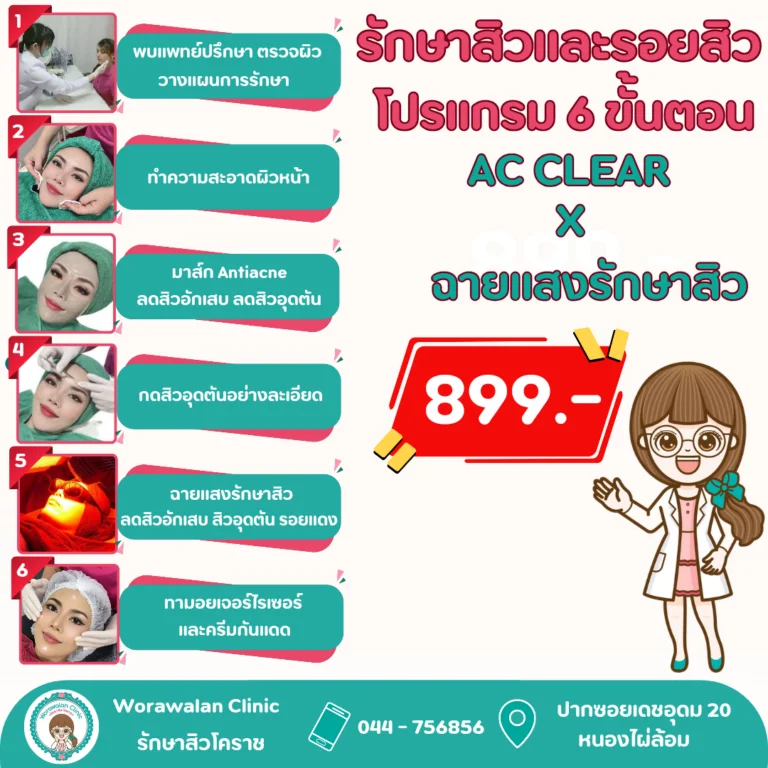 รักษาสิว โคราช โปรแกรม AC CLEAR 6 ขั้นตอน ฉายแสงรักษาสิว Healite II ราคา 899 บาท วรวลัญช์ คลินิก