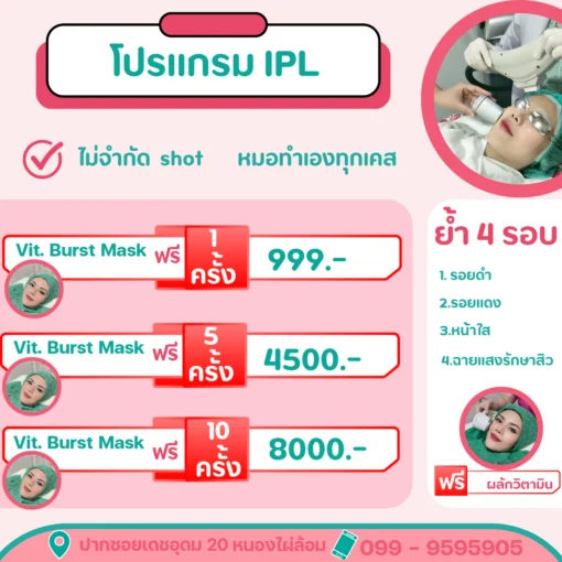 คอร์สเลเซอร์รอยสิว IPL โคราช 1 ครั้ง 5 ครั้ง และ 10 ครั้ง ราคาพิเศษ วรวลัญช์ คลินิก