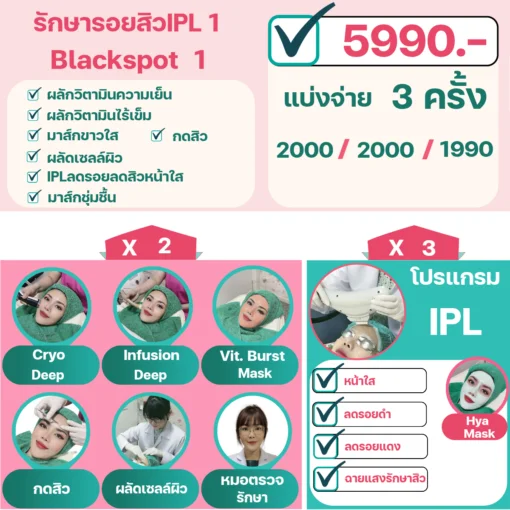 โปรโมชั่นรักษารอยสิว IPL 1 Blackspot 1 ราคา 5,990 บาท วรวลัญช์ คลินิก โคราช