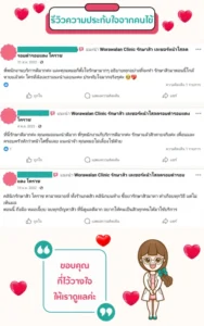 รีวิวรักษาสิวเรื้อรังและรอยดำ โคราช เคสที่ 3